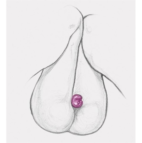 Gvibe Gring XL Sweet Raspberry