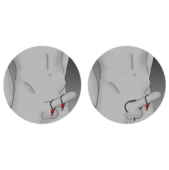 Electrastim PRESTIGE ELECTRA LOOPS ADJUSTABLE COCK RINGS BLACK